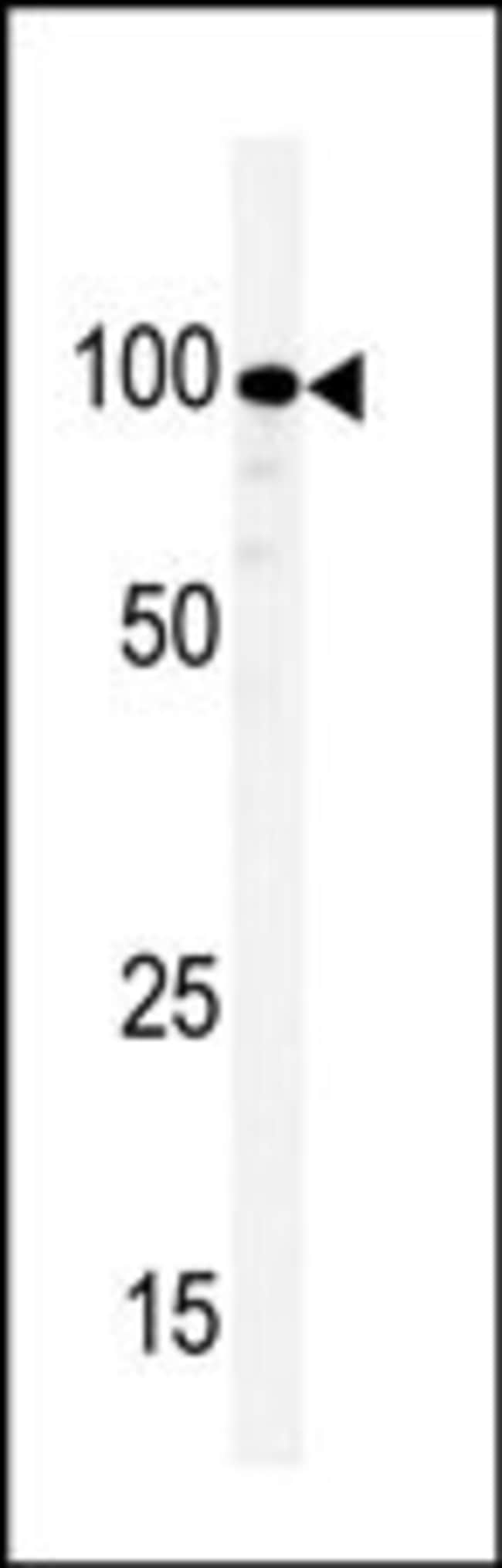 ANTI-KSR, 0,1 MG
