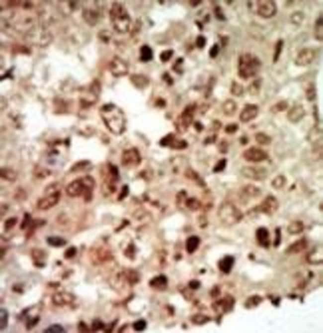 ANTI-MAPK11, 0,1 MG