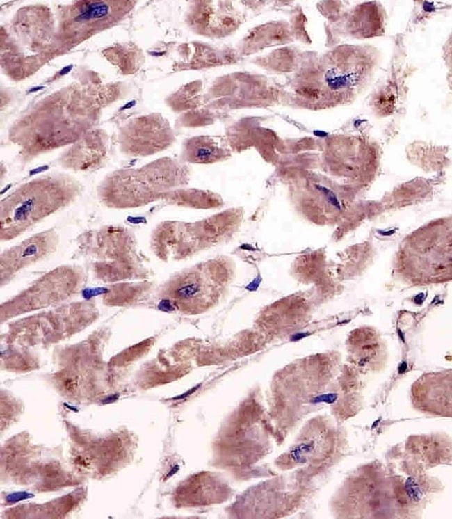 ANTI-SPHK1, 0,1 MG