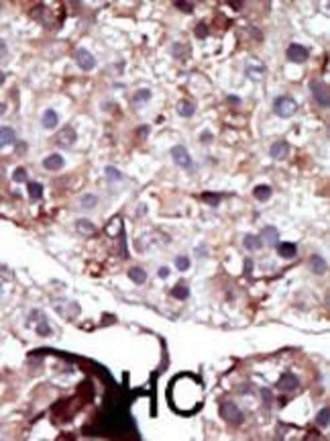 ANTI-SPHK2, 0,1 MG