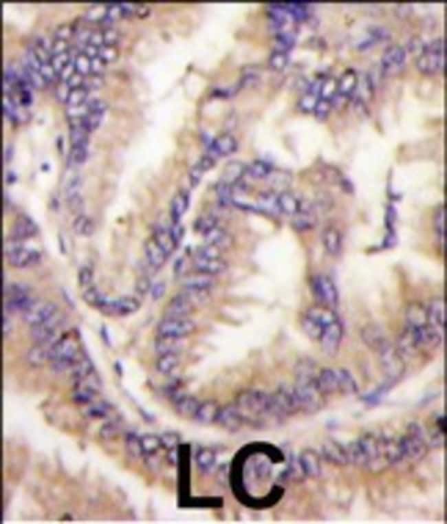 ANTI-CDKL5, 0,1mg .