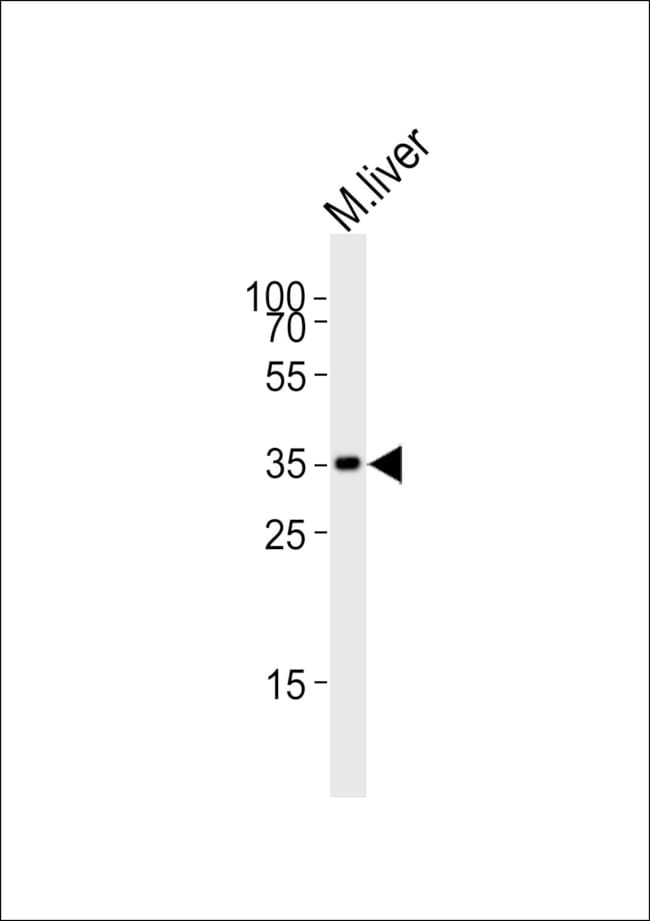 ANTI-HMX3, 0,1 MG