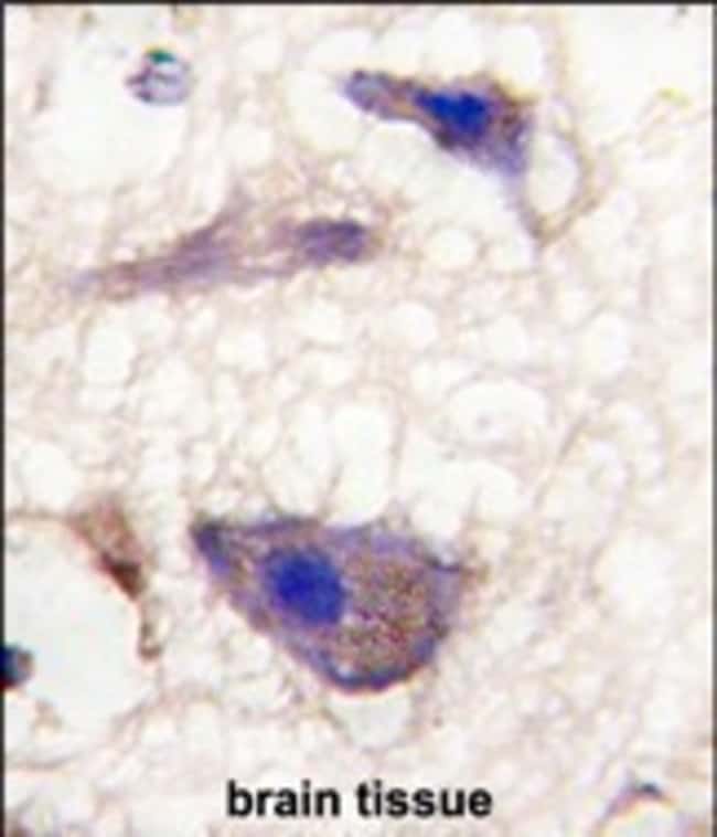 ANTI-NP1, 0,1 MG