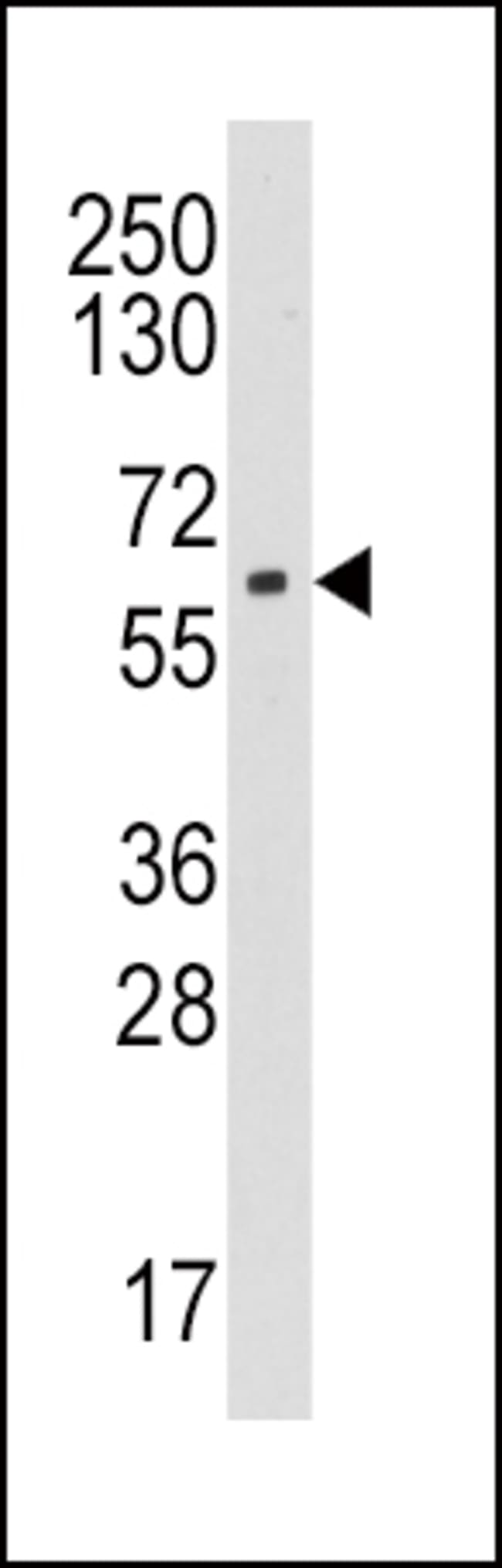 ANTI-AROMATASE, 0,1mg .
