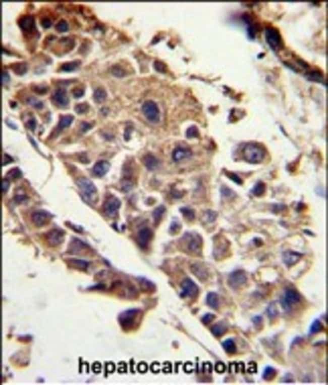 ANTI-SERPINH1, 0,1 MG