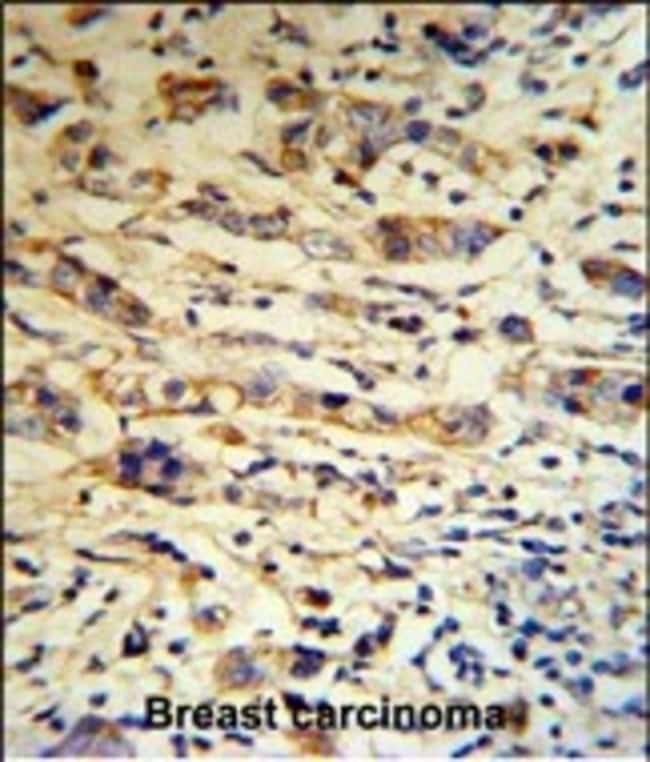 ANTI-A1BG, 0,1mg .