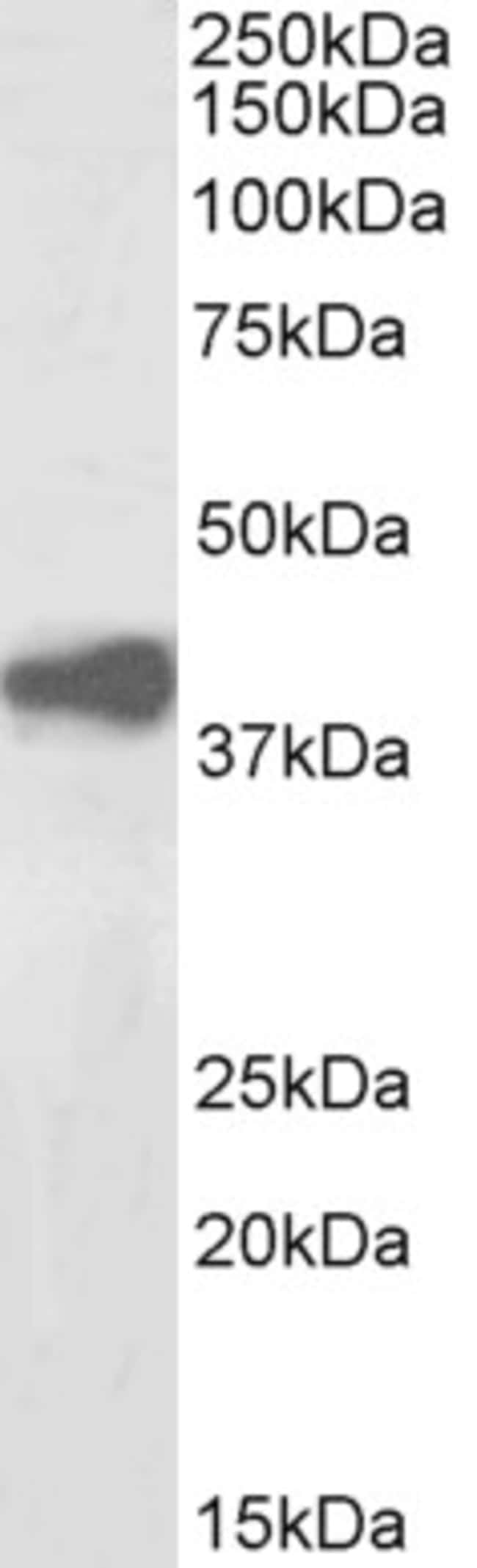 100UG ADH1A/ADH1B/ADH1C ANTIBODY BIO 100