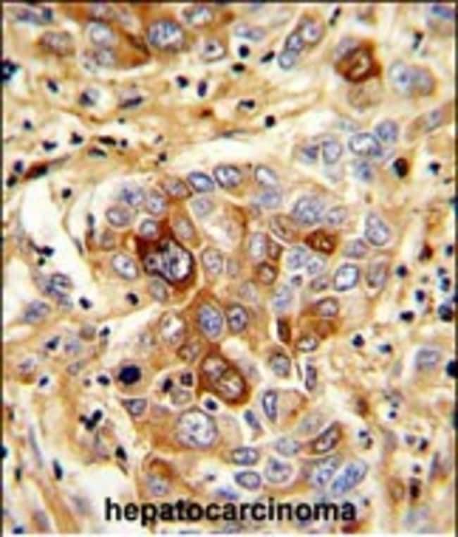 ANTI-CD163, 0,1 MG
