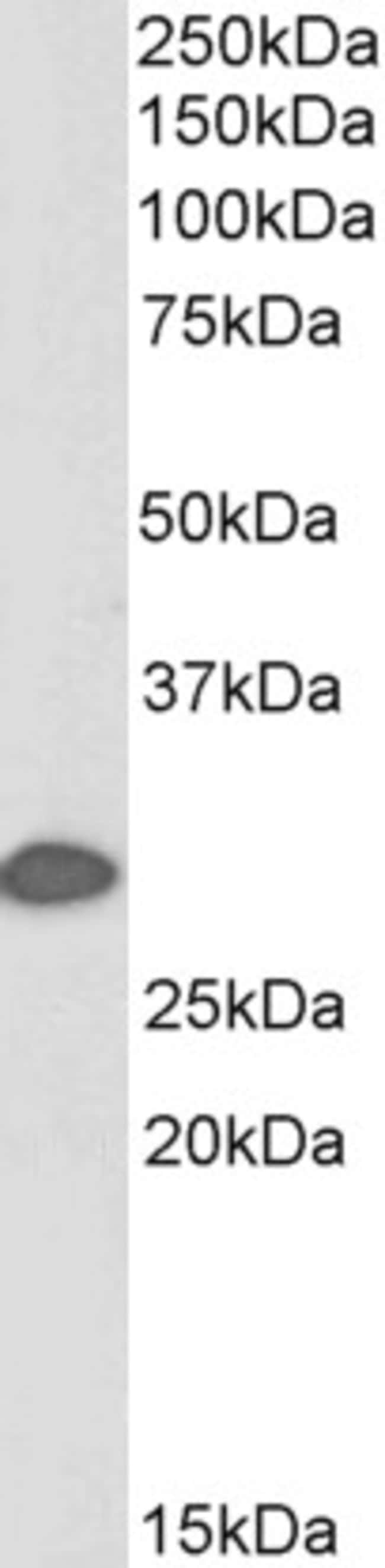 100UG 14-3-3 SIGMA ANTIBODY BIOTIN 100 U