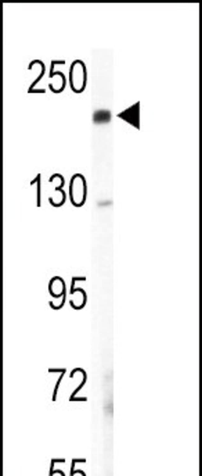 ANTI-COL5A2, 0,1 MG