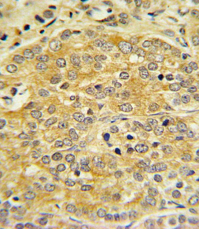 ANTI-APOL1, 0,1 MG