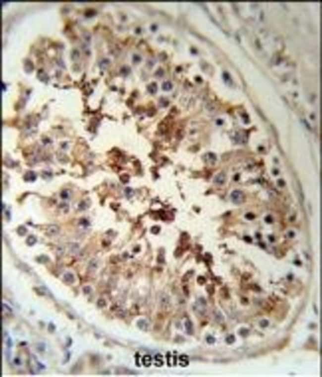 ANTI-SERPINF1, 0.1mg .