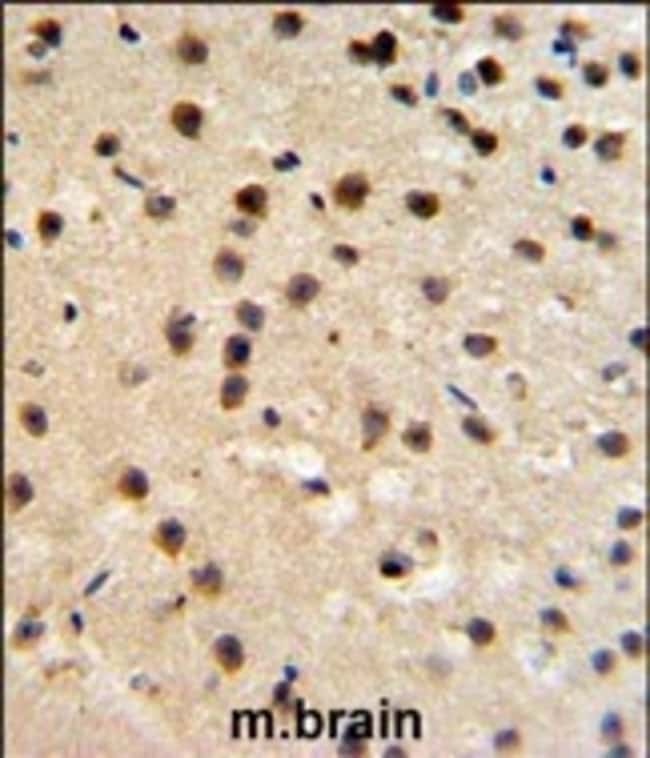ANTI-FKBP10, 0,1mg .