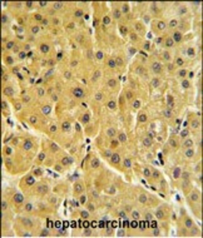 ANTI-FBP1, 0,1mg .