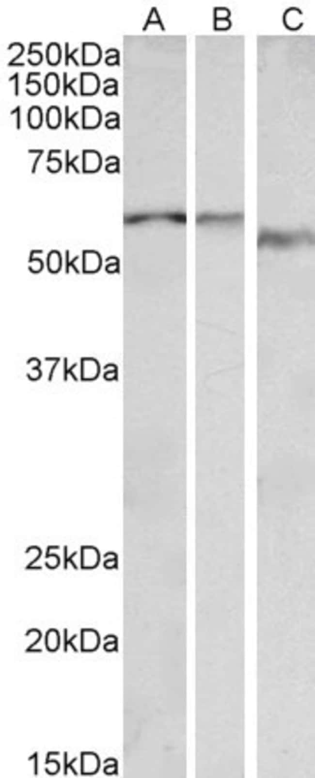 100UG ALPHA-1B ADRENERGIC RECEPTOR A 100