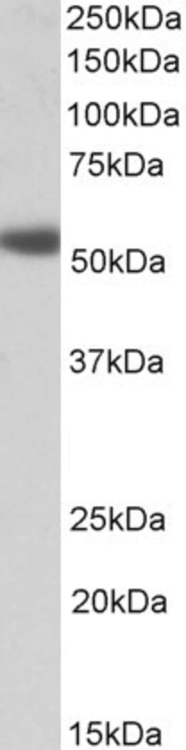 100UG ALPHA-1A ADRENERGIC RECEPTOR A 100