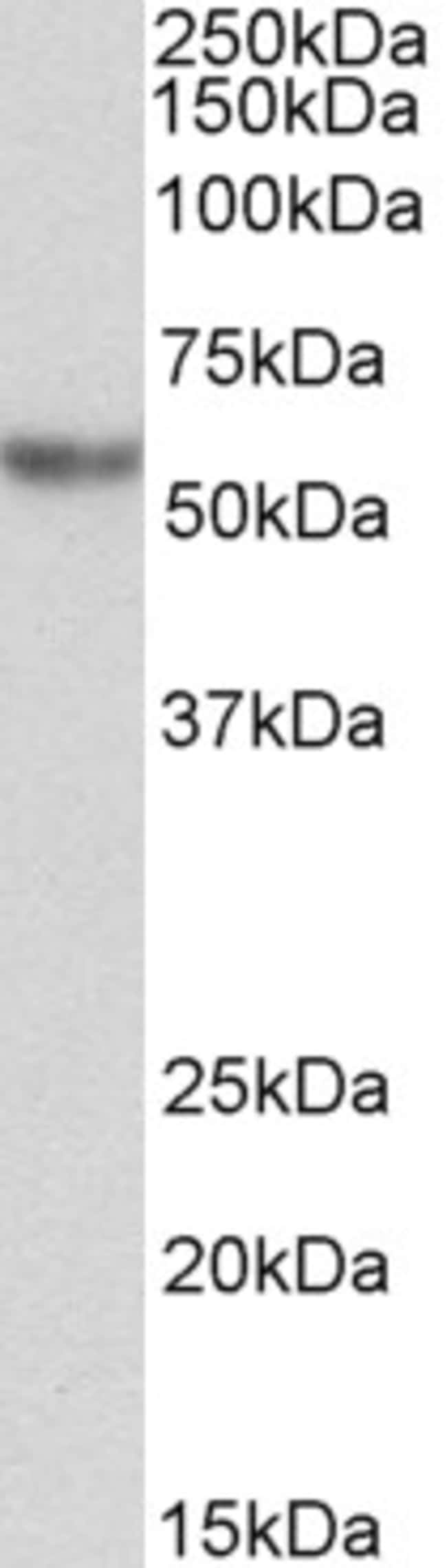 100UG ALPHA-1 ANTITRYPSIN ANTIBODY 100 U