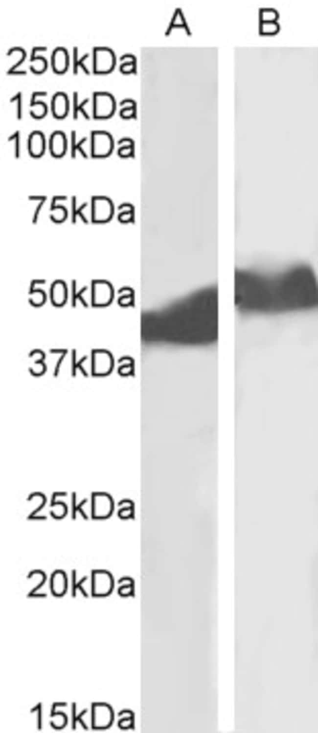 100UG ALPHA-1 ANTITRYPSIN ANTIBODY 100 U