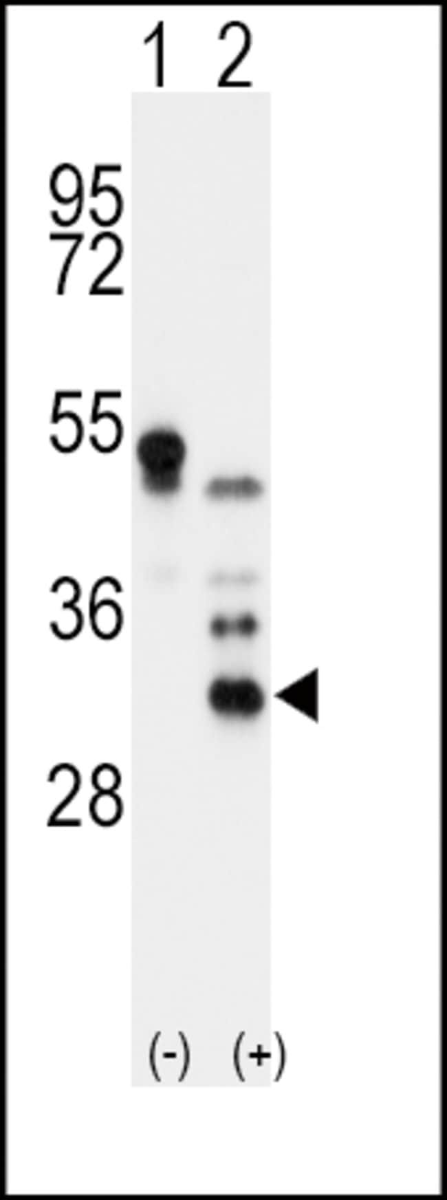 ANTI-APOD, 0,1 MG