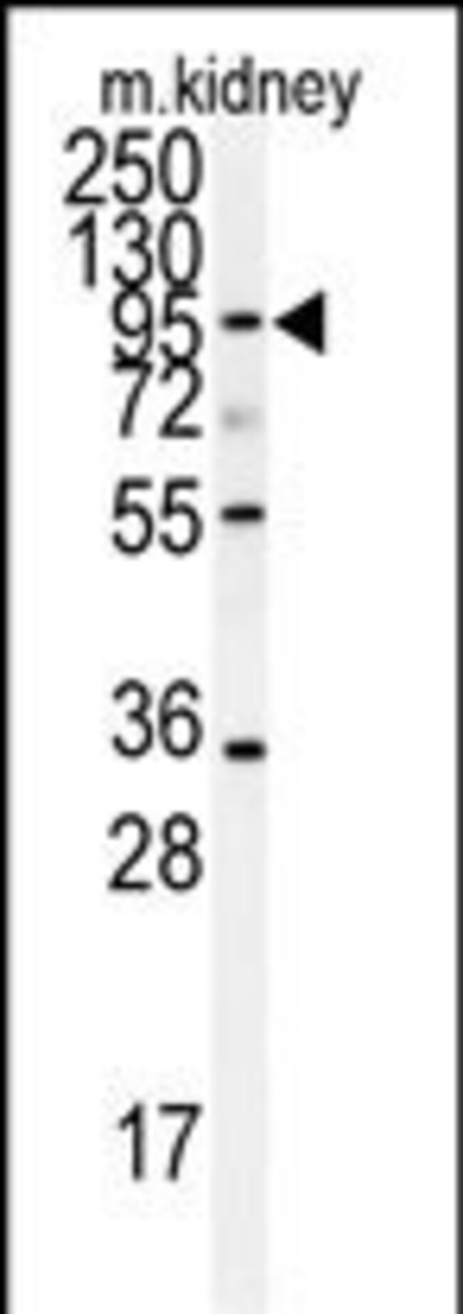 ANTI-ADAM9, 0,1 MG