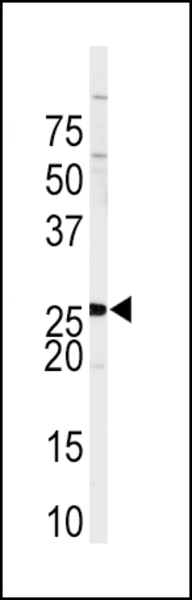 ANTI-SPRY4, 0,1 MG