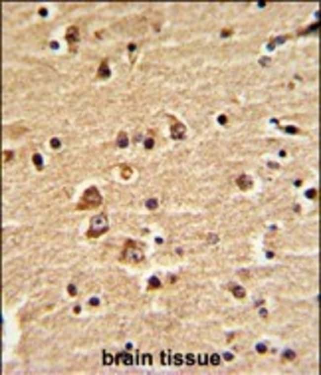 ANTI-EN2, 0,1 MG