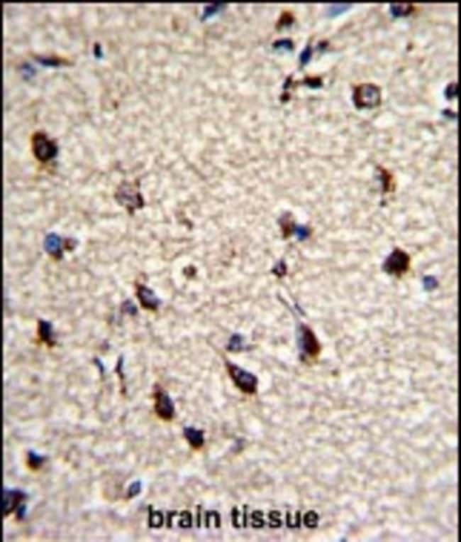 ANTI-DPT, 0.1mg .