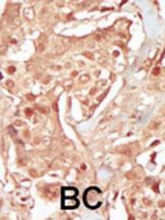 ANTI-PCTAIRE3, 0,1mg .