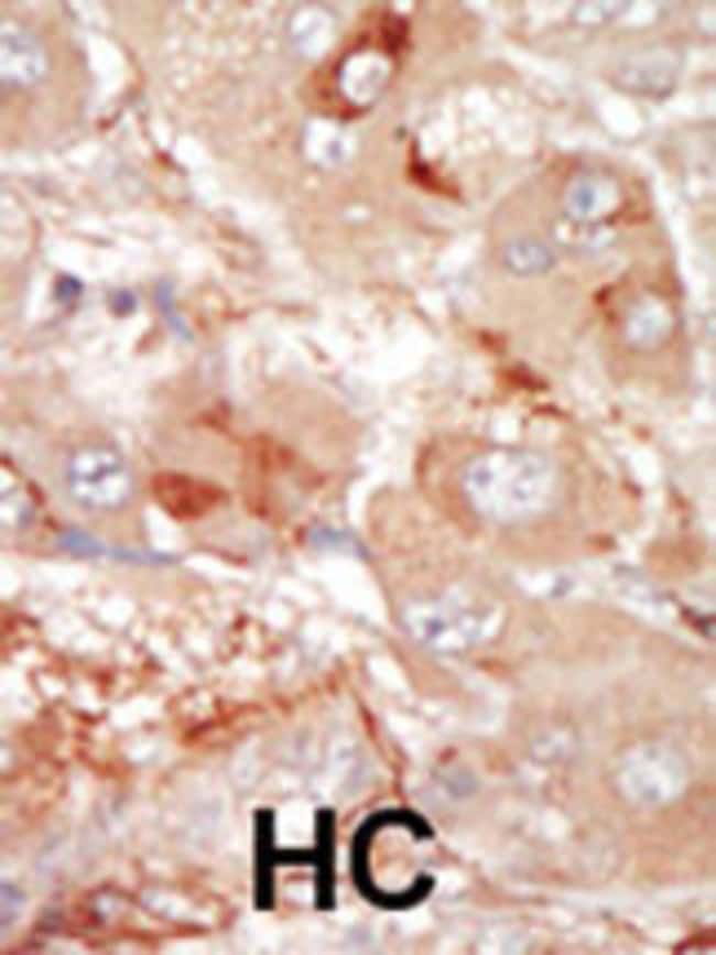 ANTI-PRP4, 0,1 MG