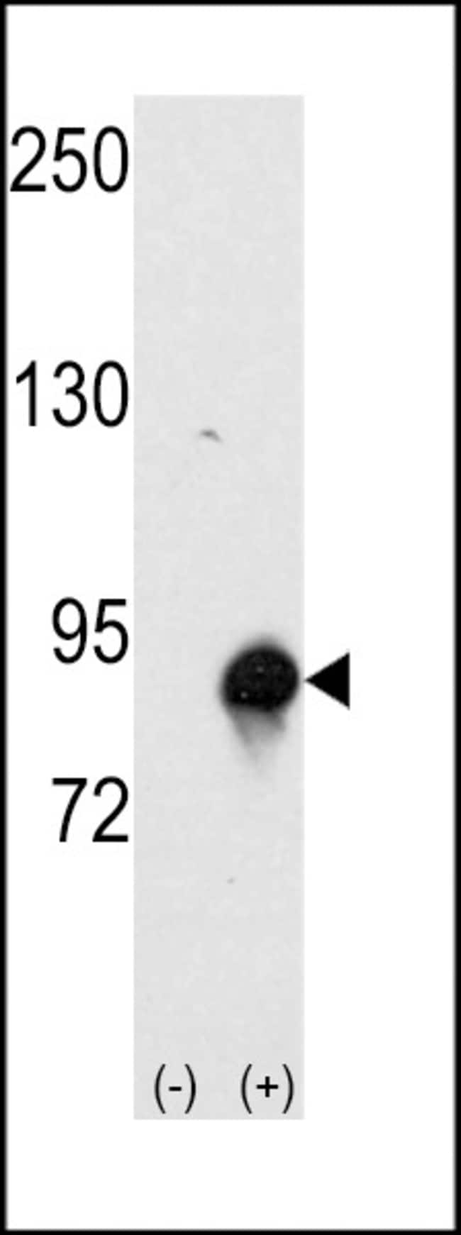 ANTI-CULLIN 4A, 0,1 MG