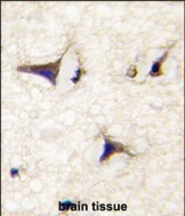 ANTI-DAAM2, 0,1 MG