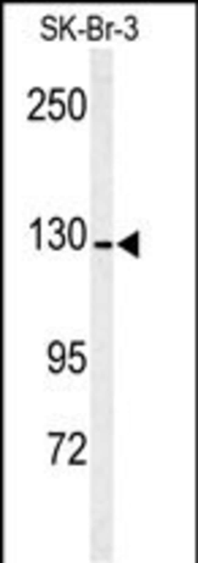 ANTI-ANPEP, 0,1 MG