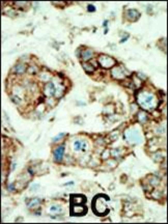 ANTI-EPHA2, 0,1mg .