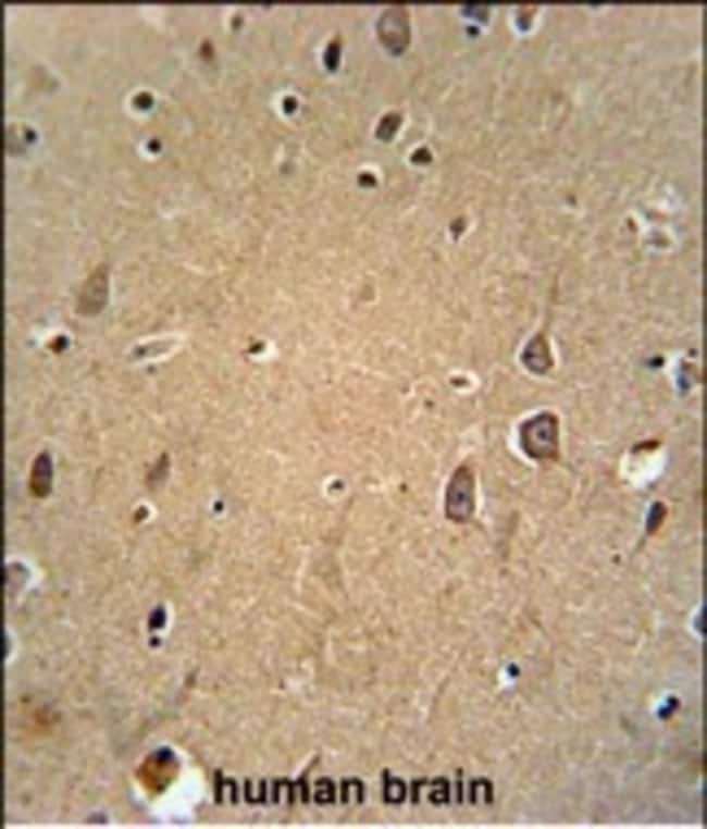 ANTI-EPH RECEPTOR A6, 0,1 MG