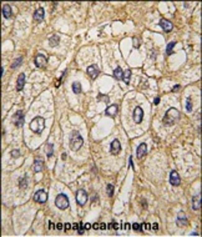 ANTI-EPHA7, 0,1mg .