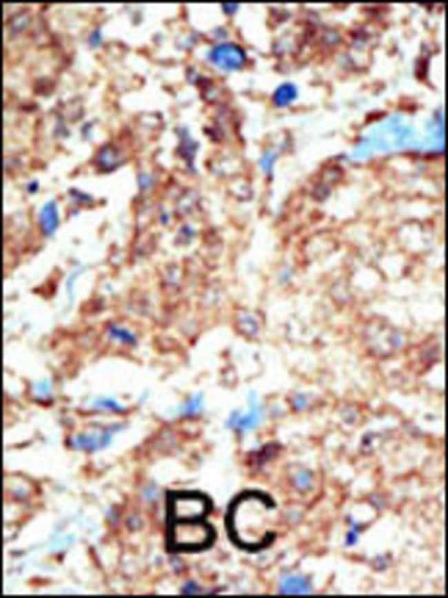 ANTI-EPHB1, 0,1 MG