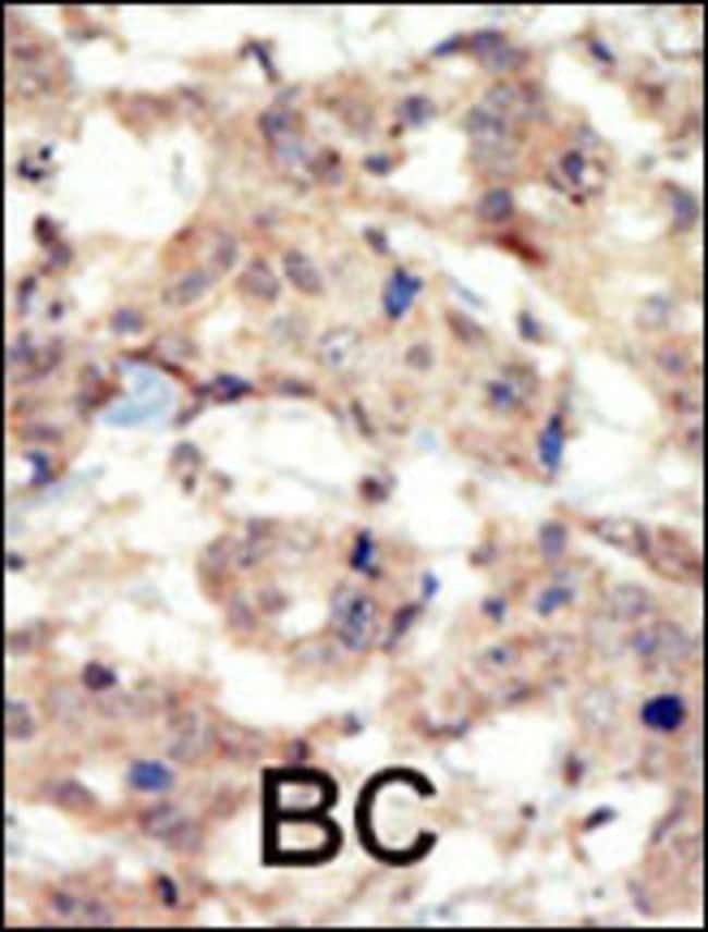 ANTI-EPHB6, 0,1mg .