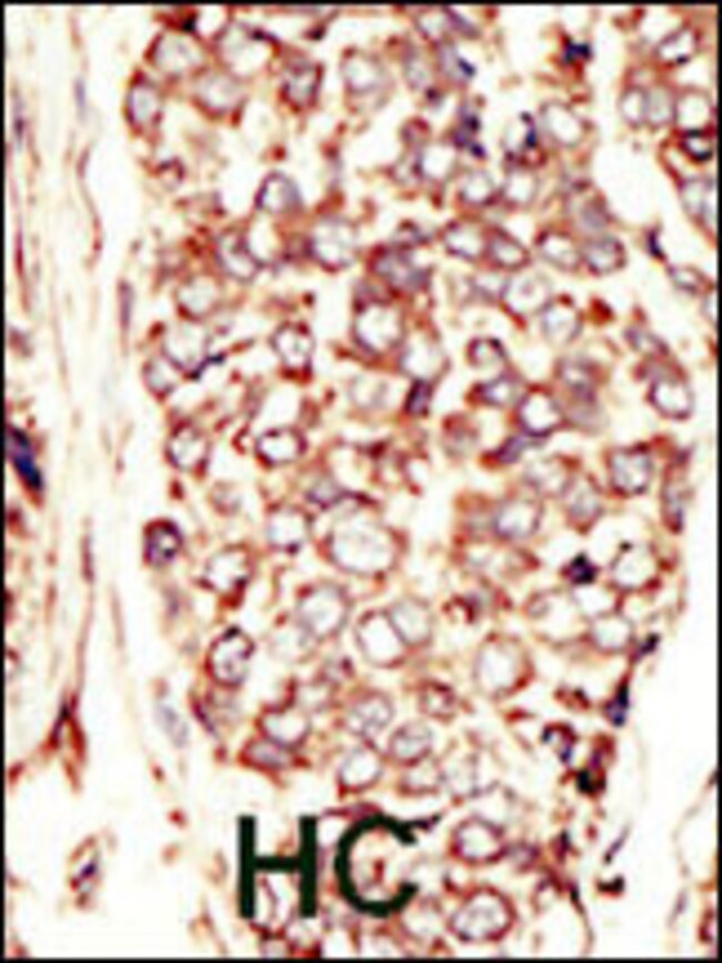ANTI-HER2/ERBB2, 0,1mg .