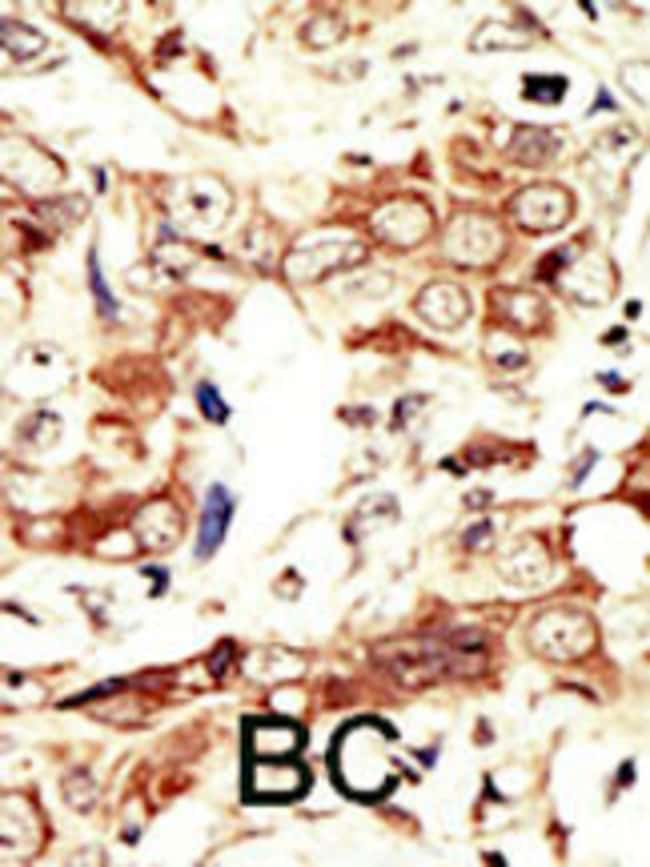ANTI-INSRR, 0,1mg .