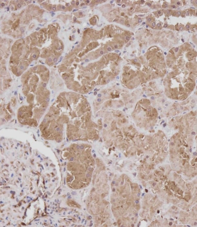 100 µG ANTI-ROR1 .
