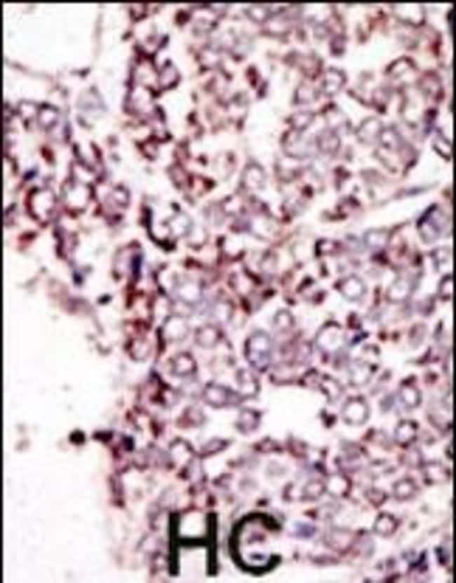 ANTI-TYRO3, 0,1mg .