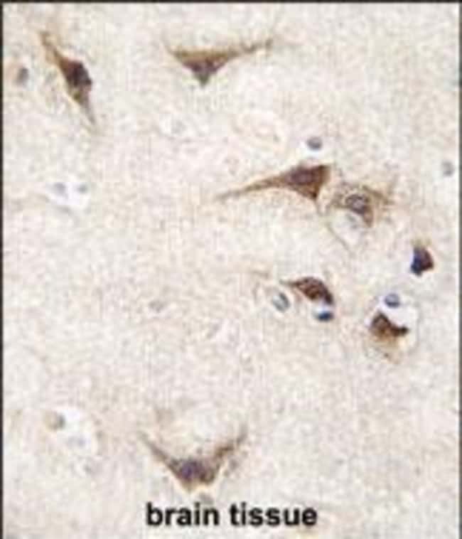 ANTI-TYRO3, 0,1mg .