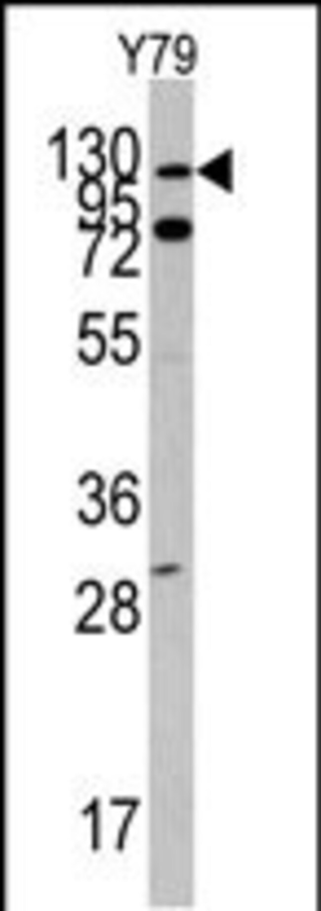 ANTI-ABL1, 0,1mg .