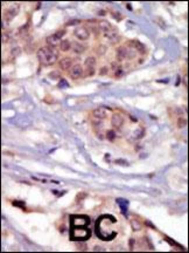 ANTI-FYN, 0,1mg (RABBIT) .
