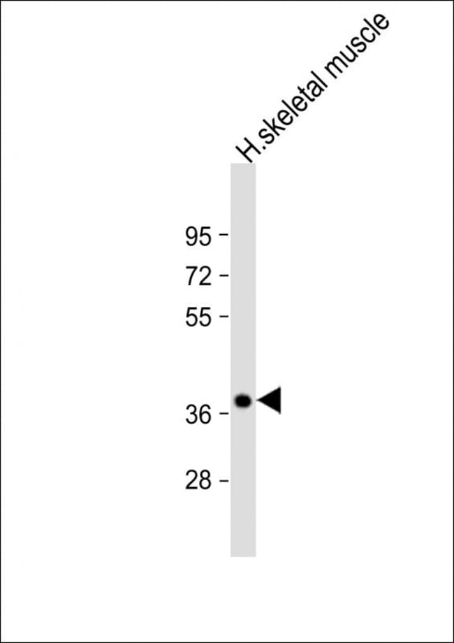 ANTI-TRIB1, 0,1 MG