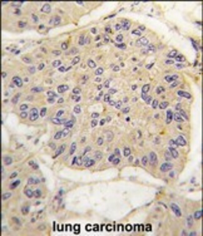 ANTI-FKBP12, 0,1mg .