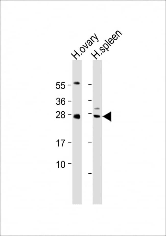 ANTI-NTF3, 0,1 MG