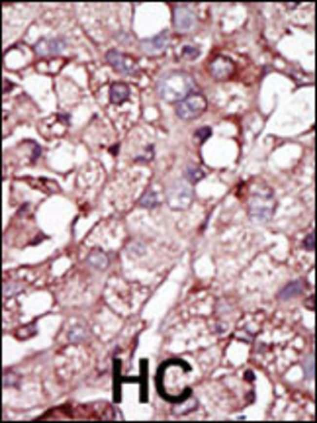 ANTI-ACVRL1, 0,1mg .