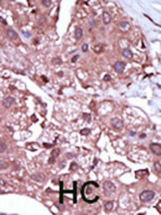 ANTI-ACVRL1, 0,1 MG