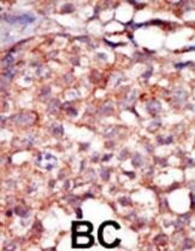 ANTI-RIPK4, 0,1mg .